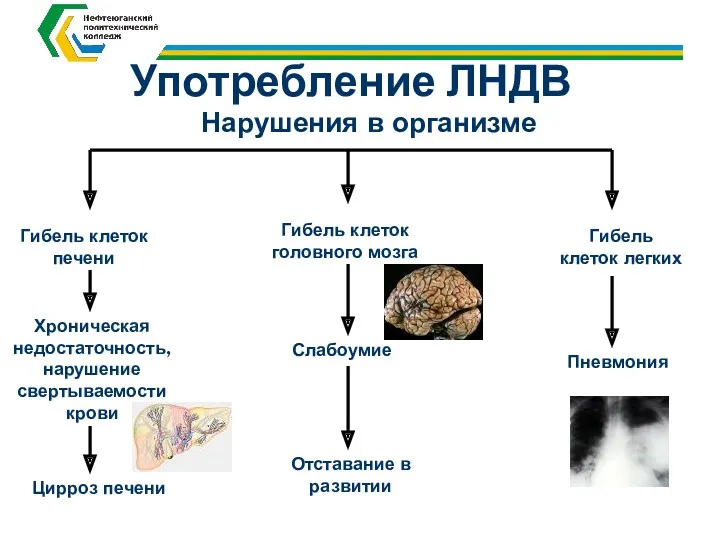 Употребление ЛНДВ Гибель клеток печени Хроническая недостаточность, нарушение свертываемости крови