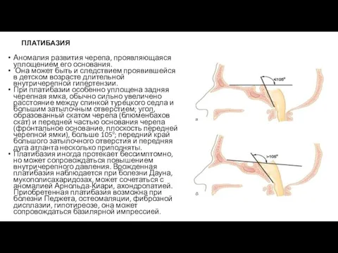 ПЛАТИБАЗИЯ Аномалия развития черепа, проявляющаяся уплощением его основания. Она может