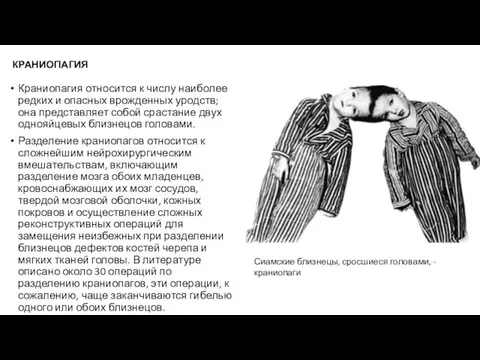 КРАНИОПАГИЯ Краниопагия относится к числу наиболее редких и опасных врожденных