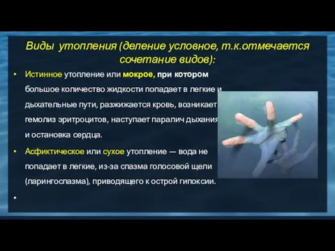 Виды утопления (деление условное, т.к.отмечается сочетание видов): Истинное утопление или