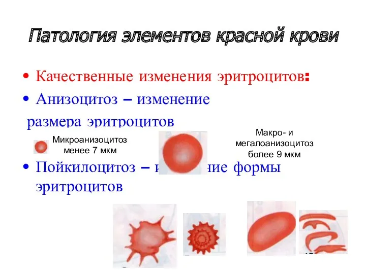 Патология элементов красной крови Качественные изменения эритроцитов: Анизоцитоз – изменение