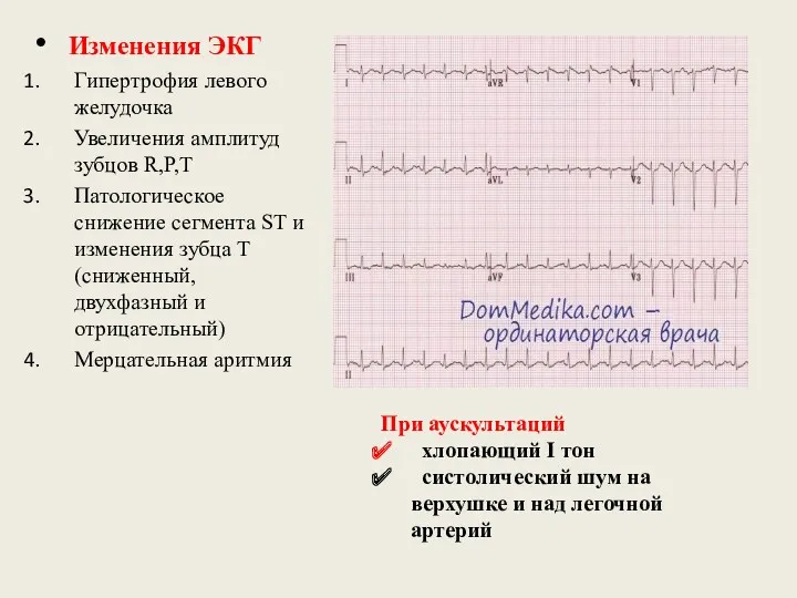 Изменения ЭКГ Гипертрофия левого желудочка Увеличения амплитуд зубцов R,P,T Патологическое