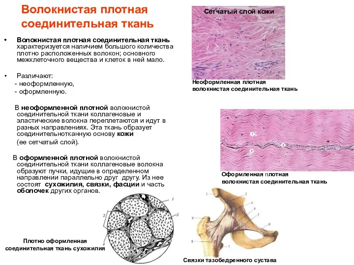 Волокнистая плотная соединительная ткань Волокнистая плотная соединительная ткань характеризуется наличием