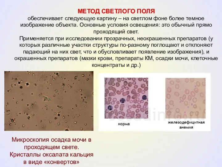 МЕТОД СВЕТЛОГО ПОЛЯ обеспечивает следующую картину – на светлом фоне