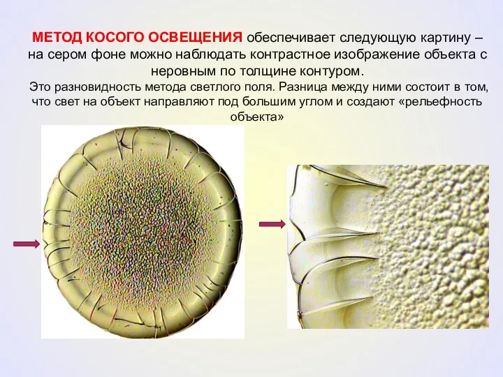 МЕТОД КОСОГО ОСВЕЩЕНИЯ обеспечивает следующую картину – на сером фоне