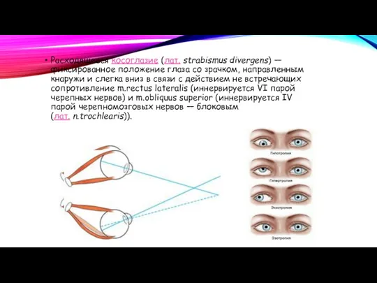 Расходящееся косоглазие (лат. strabismus divergens) — фиксированное положение глаза со