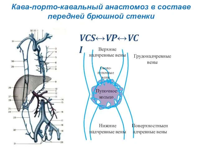 Нижние надчревные вены Пупочное кольцо Около-пупочные вены Грудонадчревные вены Поверхностныенадчревные