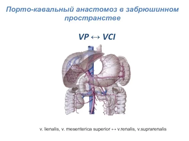 VP ↔ VCI v. lienalis, v. mesenterica superior ↔ v.renalis, v.suprarenalis Порто-кавальный анастомоз в забрюшинном пространстве