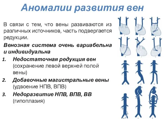 Аномалии развития вен В связи с тем, что вены развиваются