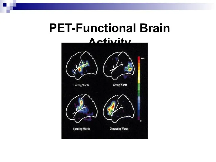 PET-Functional Brain Activity