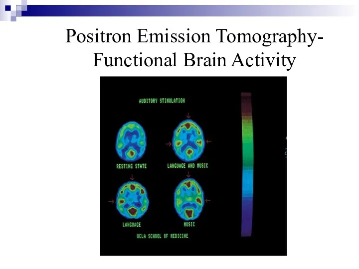 Positron Emission Tomography- Functional Brain Activity