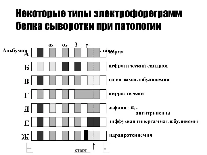 Некоторые типы электрофореграмм белка сыворотки при патологии