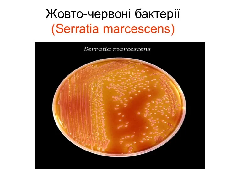 Жовто-червоні бактерії (Serratia marcescens)