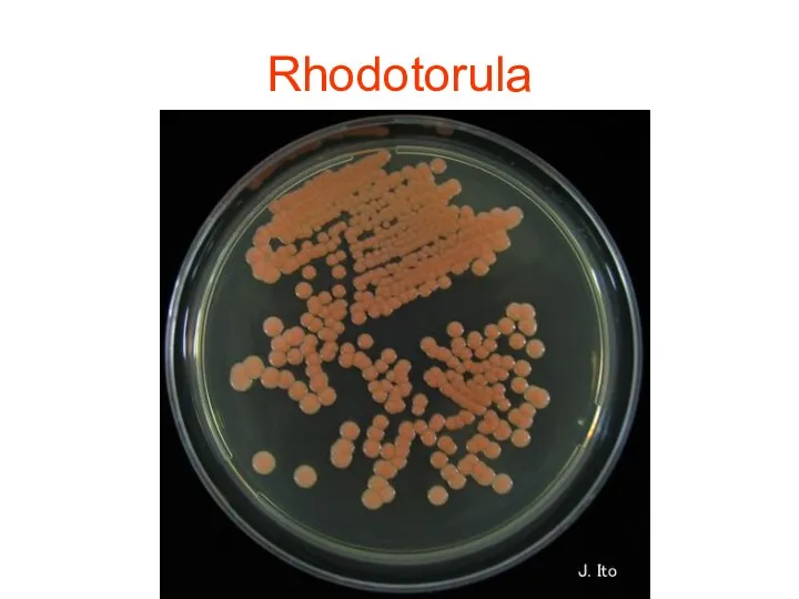 Rhodotorula