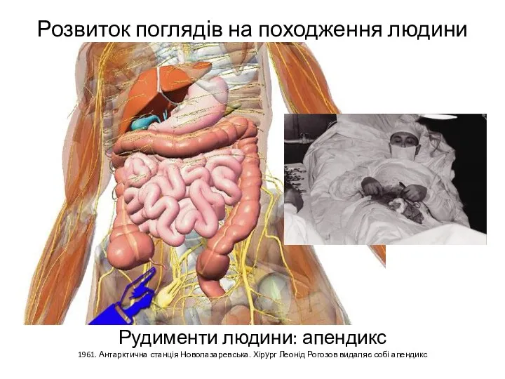 Розвиток поглядів на походження людини Рудименти людини: апендикс 1961. Антарктична