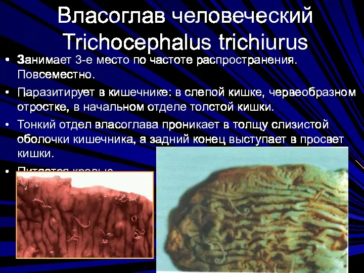 Власоглав человеческий Trichocephalus trichiurus Занимает 3-е место по частоте распространения.