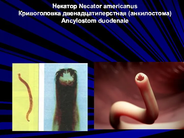 Некатор Necator americanus Кривоголовка двенадцатиперстная (анкилостома) Ancylostom duodenale