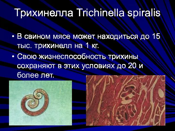 Трихинелла Trichinella spiralis В свином мясе может находиться до 15