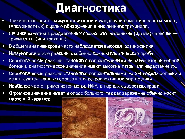 Диагностика Трихинеллоскопия - микроскопическое исследование биоптированных мышц (мяса животных) с