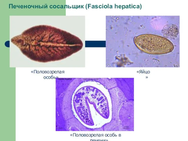 Печеночный сосальщик (Fasciola hepatica) «Половозрелая особь в печени» «Половозрелая особь» «Яйцо»