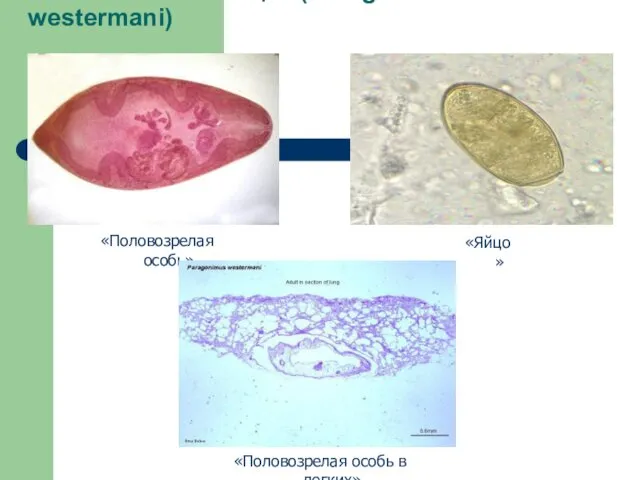 Легочный сосальщик (Paragonimus westermani) «Половозрелая особь» «Половозрелая особь в легких» «Яйцо»