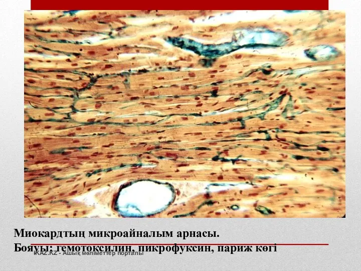 Миокардтың микроайналым арнасы. Бояуы: гемотоксилин, пикрофуксин, париж көгі IKAZ.KZ - Ашық мәліметтер порталы