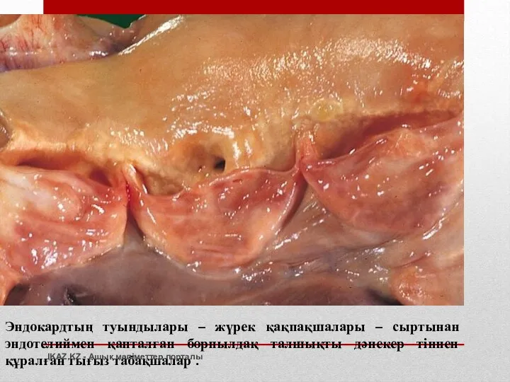 Эндокардтың туындылары – жүрек қақпақшалары – сыртынан эндотелиймен қапталған борпылдақ талшықты дәнекер тіннен