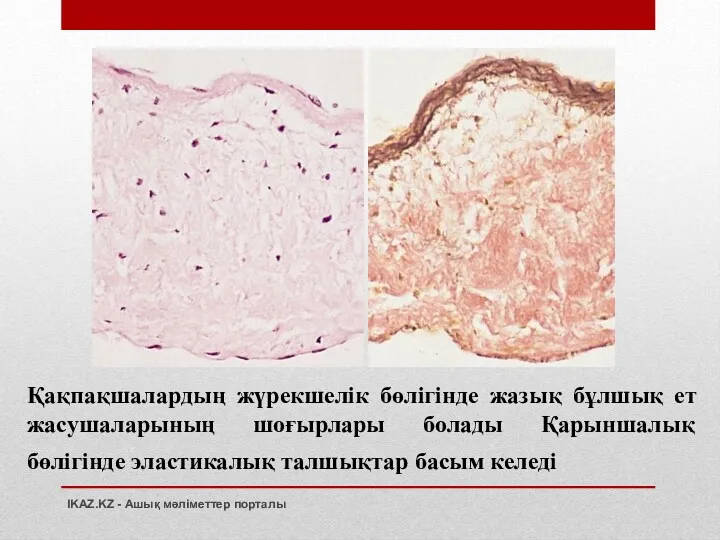 Қақпақшалардың жүрекшелік бөлігінде жазық бұлшық ет жасушаларының шоғырлары болады Қарыншалық