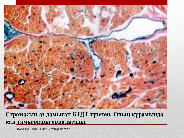 Стромасын аз дамыған БТДТ түзеген. Оның құрамында қан тамырлары орналасады. IKAZ.KZ - Ашық мәліметтер порталы