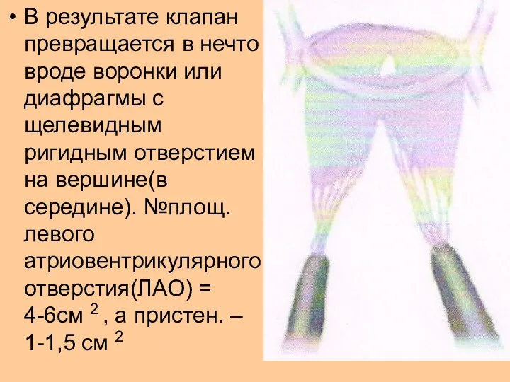 В результате клапан превращается в нечто вроде воронки или диафрагмы