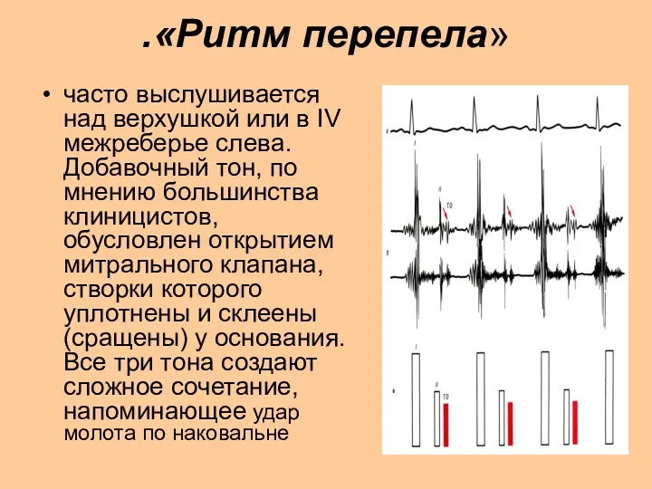 .«Ритм перепела» часто выслушивается над верхушкой или в IV межреберье