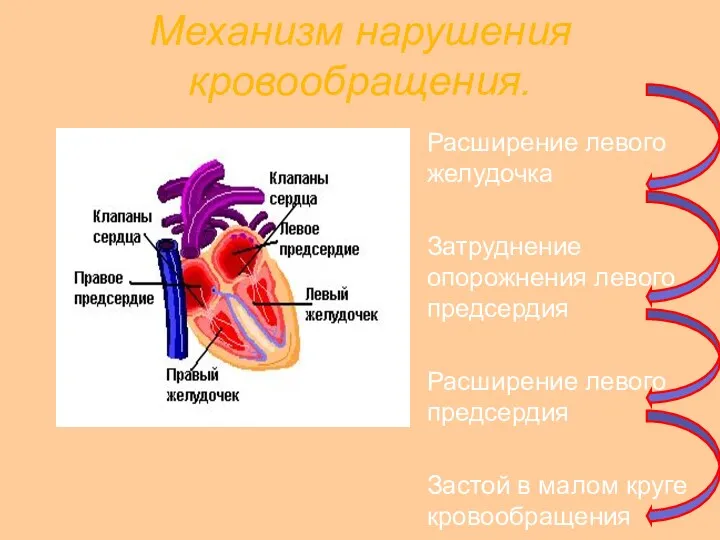 Механизм нарушения кровообращения. Расширение левого желудочка Затруднение опорожнения левого предсердия