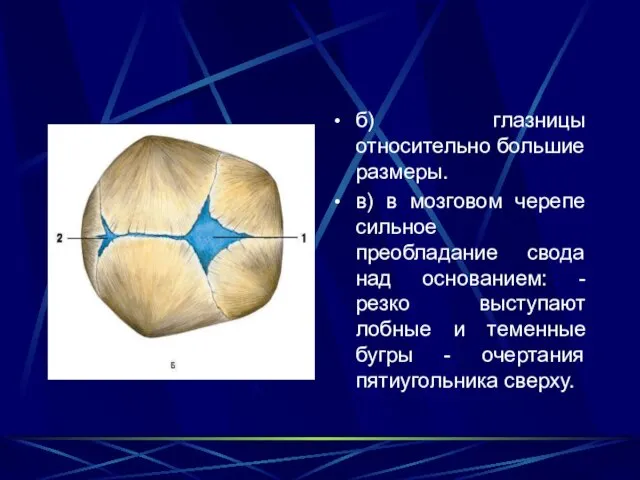 б) глазницы относительно большие размеры. в) в мозговом черепе сильное