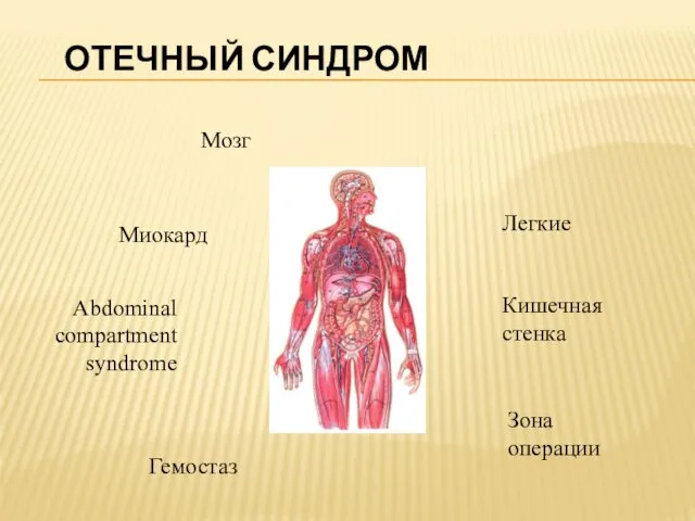 ОТЕЧНЫЙ СИНДРОМ Мозг Легкие Миокард Кишечная стенка Abdominal compartment syndrome Зона операции Гемостаз