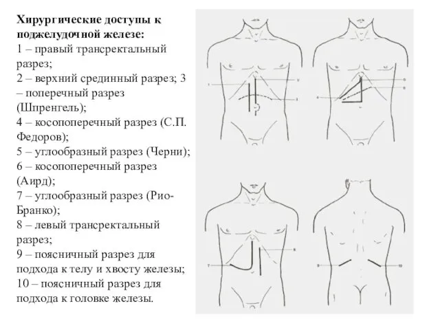 Хирургические доступы к поджелудочной железе: 1 – правый трансректальный разрез;