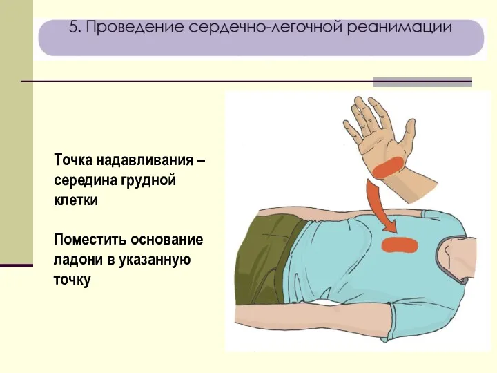 Точка надавливания – середина грудной клетки Поместить основание ладони в указанную точку