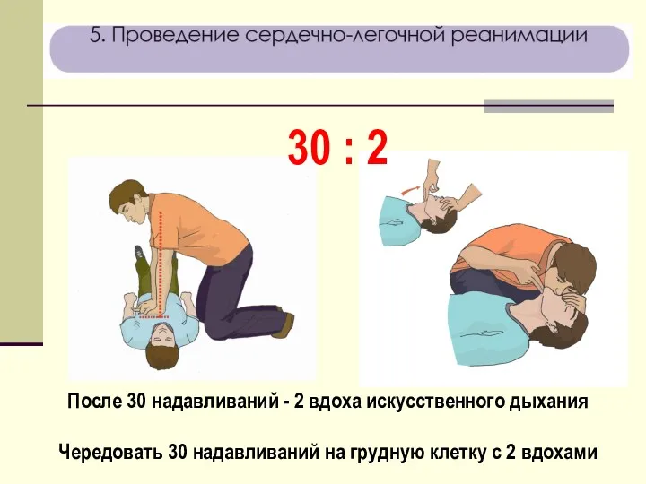 После 30 надавливаний - 2 вдоха искусственного дыхания Чередовать 30