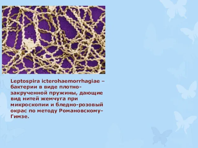 Leptospira icterohaemorrhagiae – бактерии в виде плотно-закрученной пружины, дающие вид