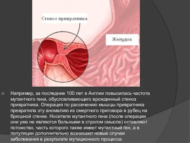 Например, за последние 100 лет в Англии повысилась частота мутантного