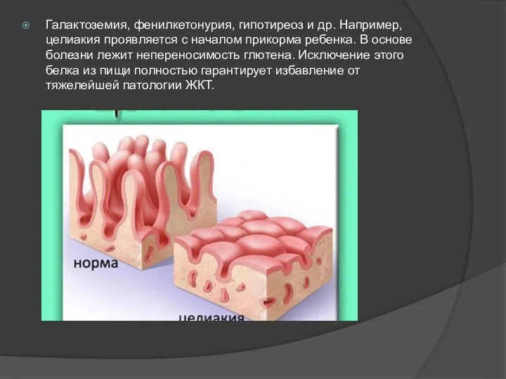 Галактоземия, фенилкетонурия, гипотиреоз и др. Например, целиакия проявляется с началом