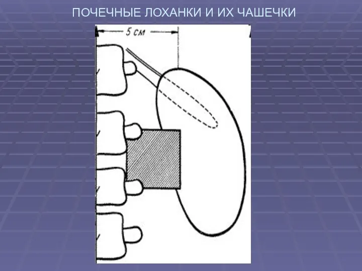 ПОЧЕЧНЫЕ ЛОХАНКИ И ИХ ЧАШЕЧКИ