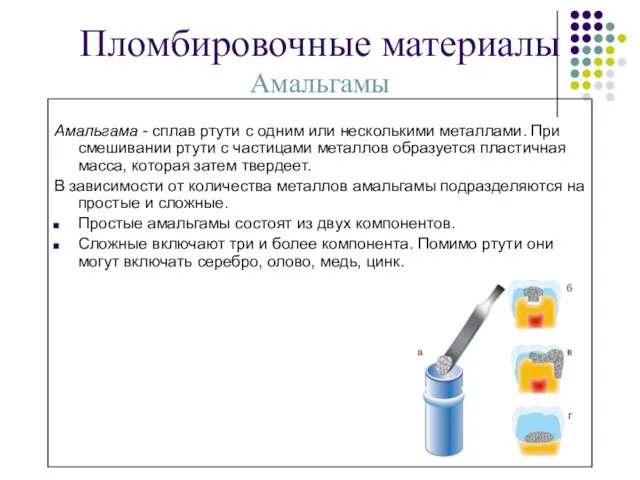 Пломбировочные материалы Амальгамы Амальгама - сплав ртути с одним или