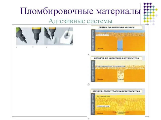 Пломбировочные материалы Адгезивные системы