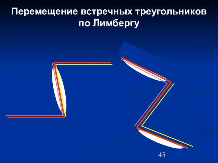 Перемещение встречных треугольников по Лимбергу