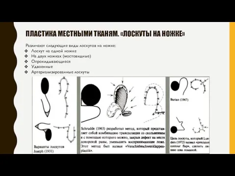 ПЛАСТИКА МЕСТНЫМИ ТКАНЯМ. «ЛОСКУТЫ НА НОЖКЕ» Различают следующие виды лоскутов