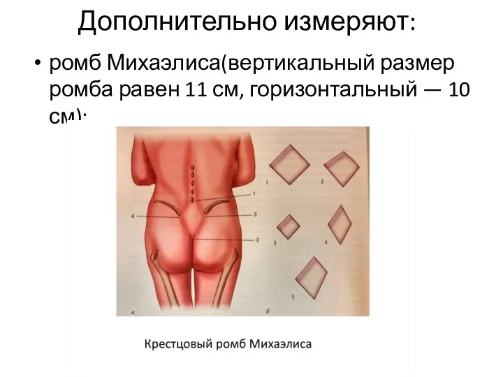 Дополнительно измеряют: ромб Михаэлиса(вертикальный размер ромба равен 11 см, горизонтальный — 10 см);