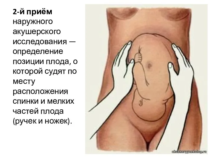 2-й приём наружного акушерского исследования — определение позиции плода, о которой судят по