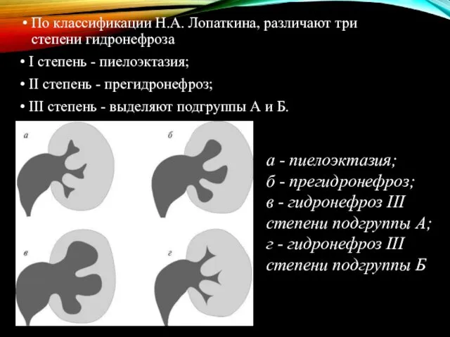 По классификации Н.А. Лопаткина, различают три степени гидронефроза • I степень - пиелоэктазия;