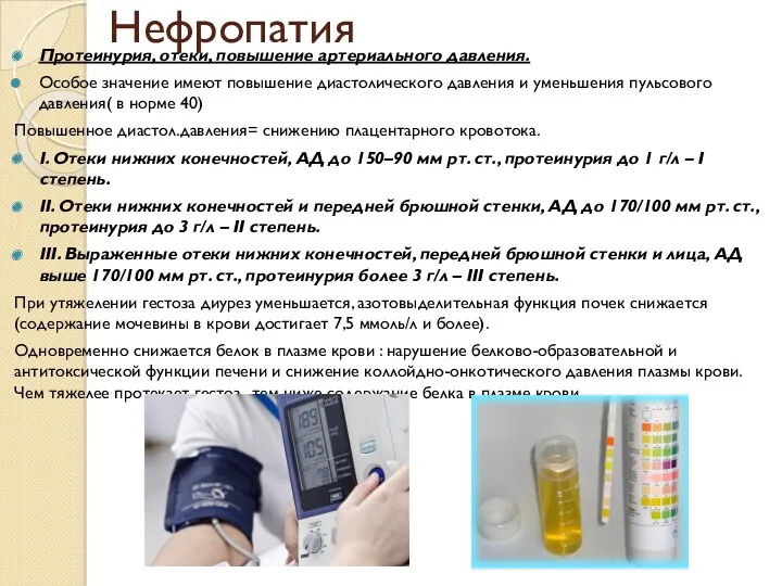 Нефропатия Протеинурия, отеки, повышение артериального давления. Особое значение имеют повышение