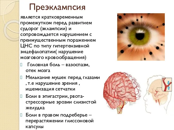 Преэклампсия является кратковременным промежутком перед развитием судорог (эклампсии) и сопровождается